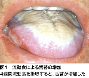 舌苔の写真